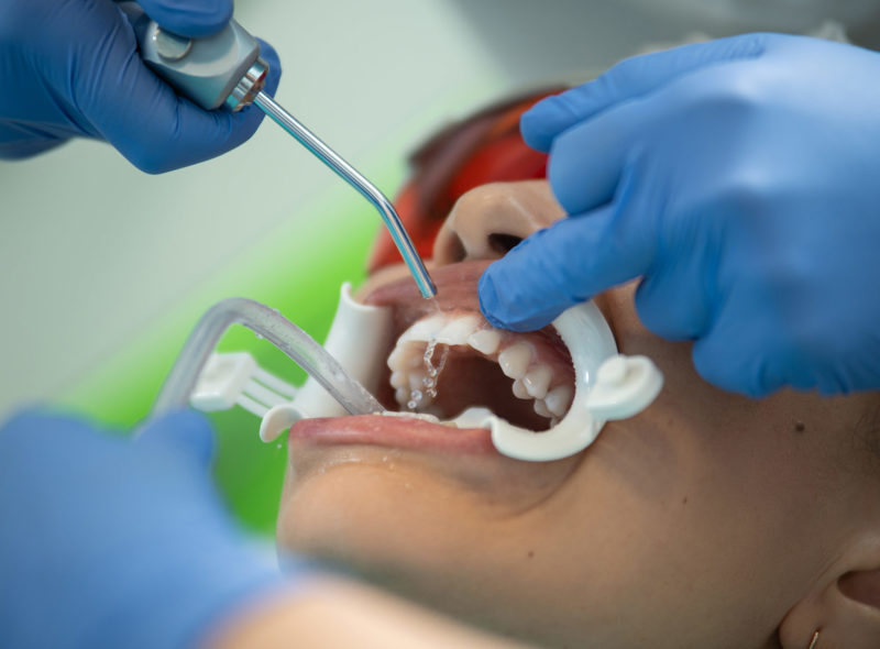 Beratungsansätze in der Zahnarztpraxis